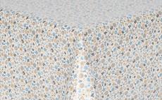 Crazy Daisy Oilcloth